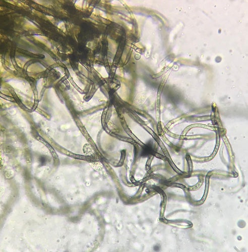 Chaetomium — Bild 2