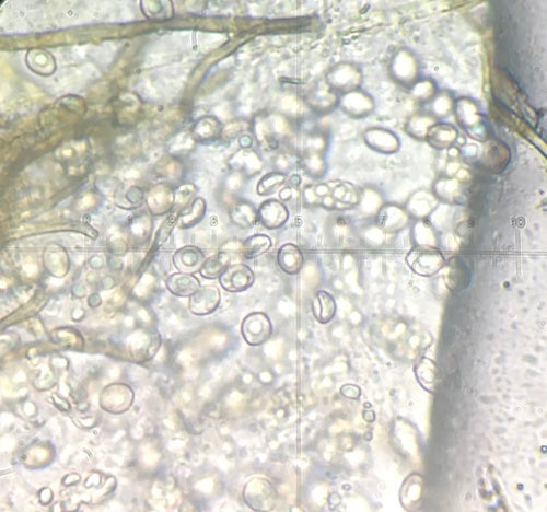 Chaetomium kuliste — Bild 3