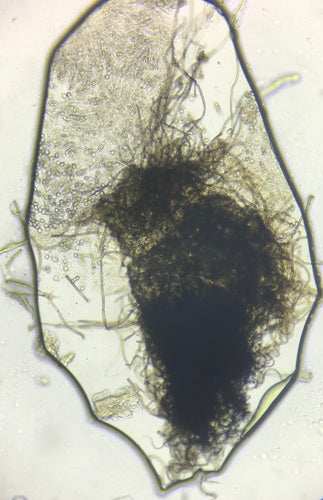 Chaetomium kuliste — Bild 5