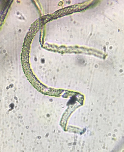 Chaetomium kuliste — Bild 4