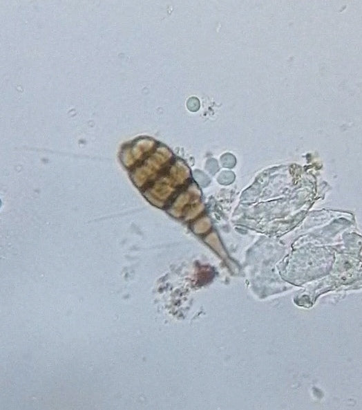 Alternaria — zdjęcie 5 z 8