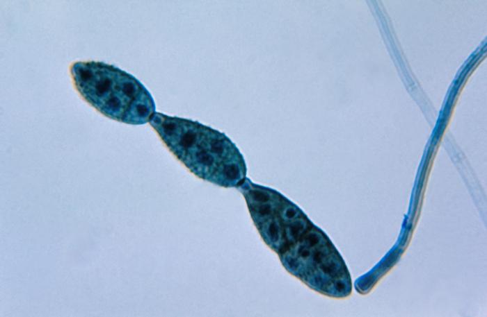 Alternaria — zdjęcie 2 z 8