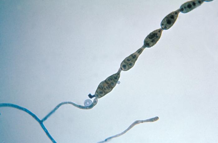 Alternaria — zdjęcie 3 z 8